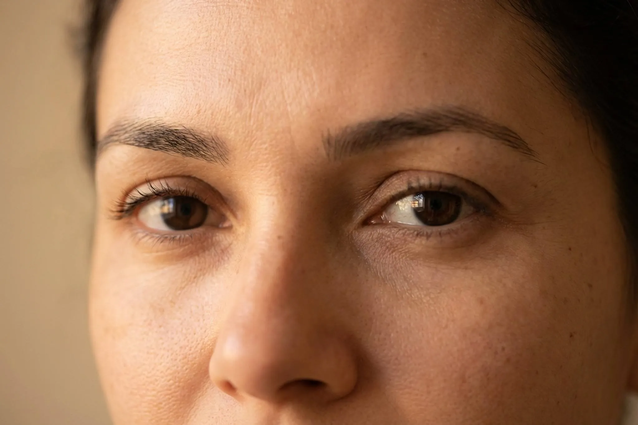 Blefaroplastia Transconjuntival