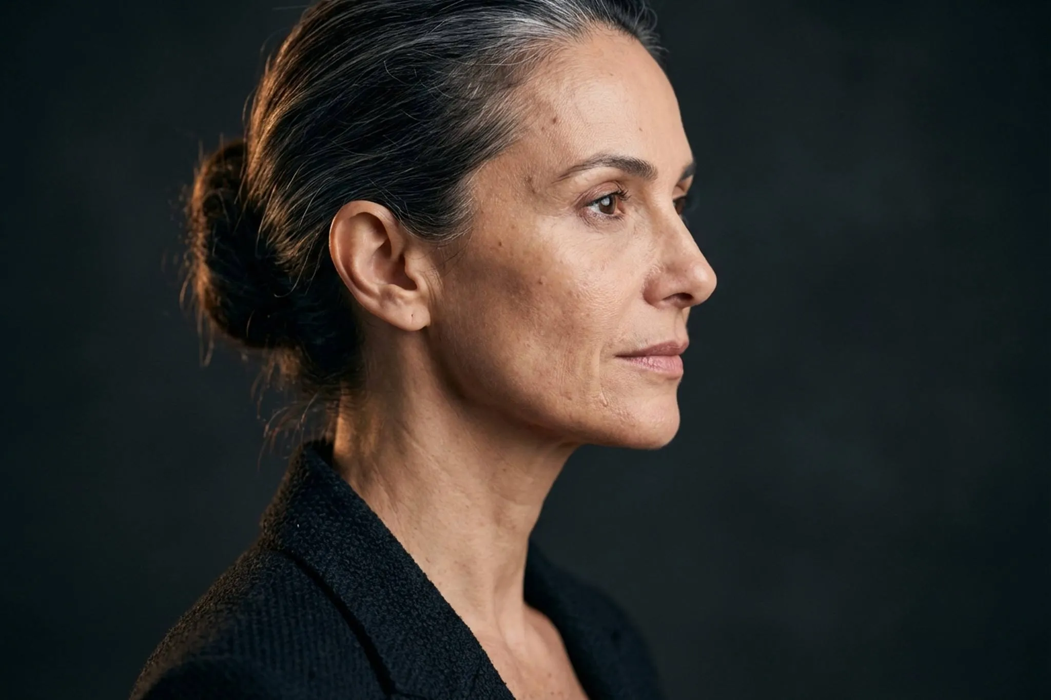 Neck lift e deep neck lift em Londrina